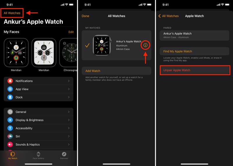Apple Watch ausgliedern