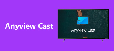 Casting Anyview