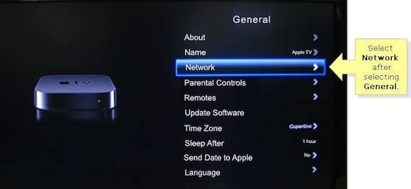 Ellenőrizze az Apple TV hálózati csatlakozását